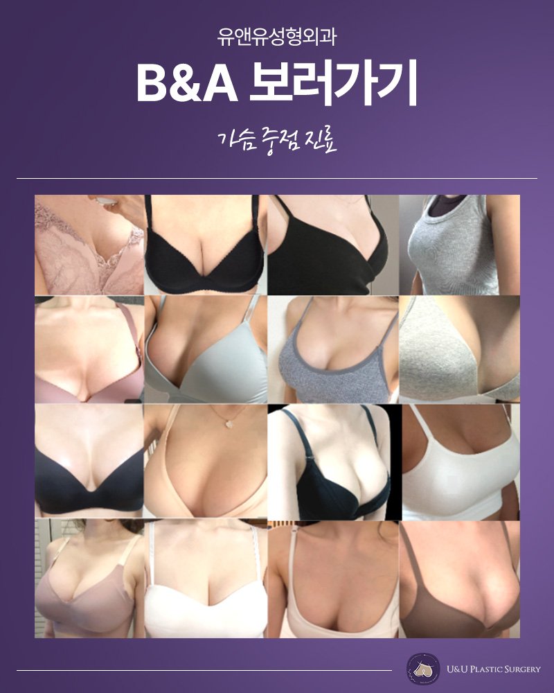 가슴수술 원내검사 병원